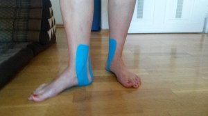 Sport-Tape bei Plantarsehnenreizung