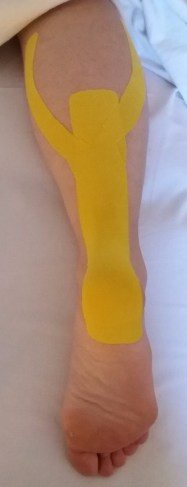 Sport-Tape gegen Achillessehnenentzündung