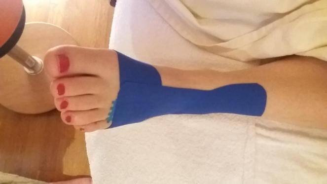 Schmerzen an der Außenseite