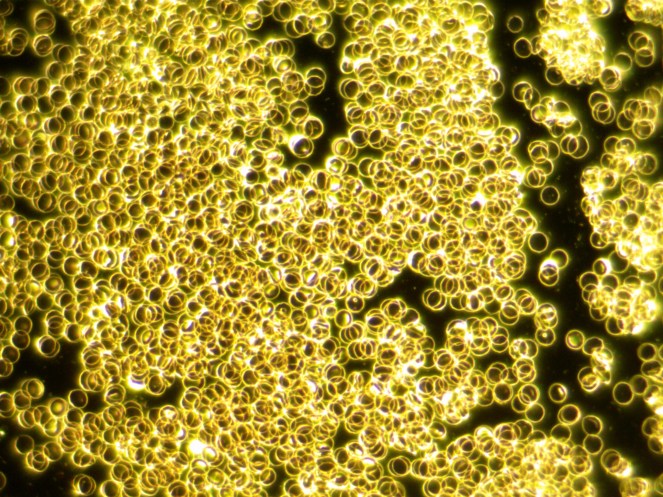 zu viel Eiweiß im Blut