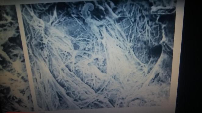 Faszien Heilung am Bewegungsapparat